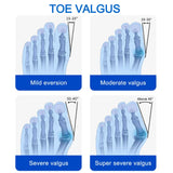 Corrector de Juanetes | Bunion Splint Enderezador de Dedo Gordo – Ortesis Ajustable para Hallux Valgus